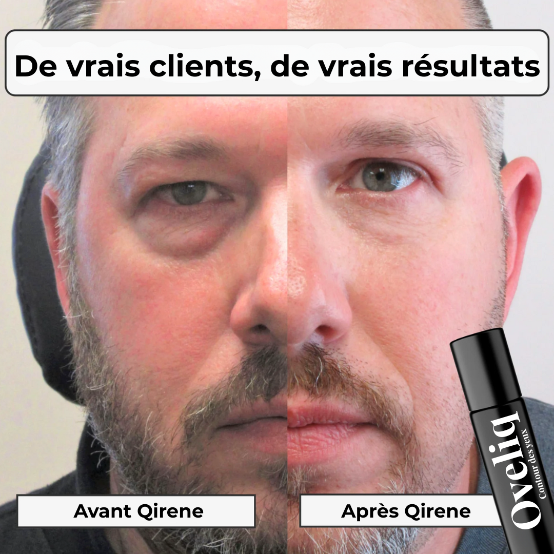 Oveliq | Contour des yeux